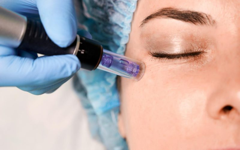 Best Aesthetic Clinic in Dubai